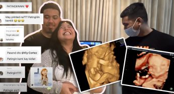 LOOK: Viy Cortez Proudly Flaunts Pregnancy Stretch Marks - ViyLine Media  Group